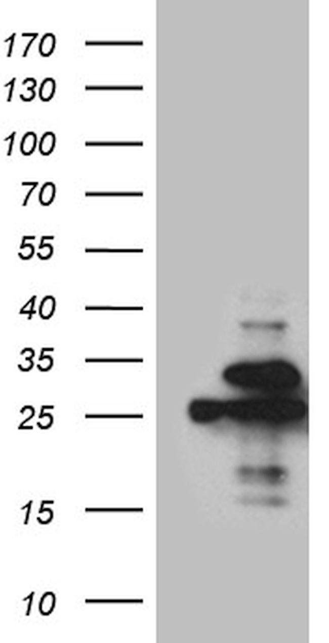PGAM4 Antibody in Western Blot (WB)