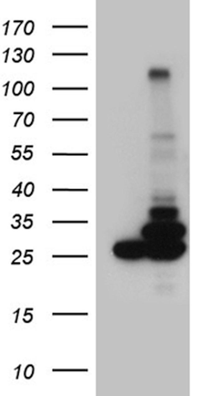 PGAM4 Antibody in Western Blot (WB)