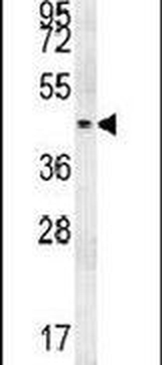 PGAP2 Antibody in Western Blot (WB)
