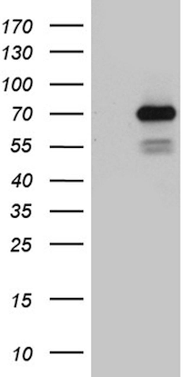 PGBD3 Antibody in Western Blot (WB)