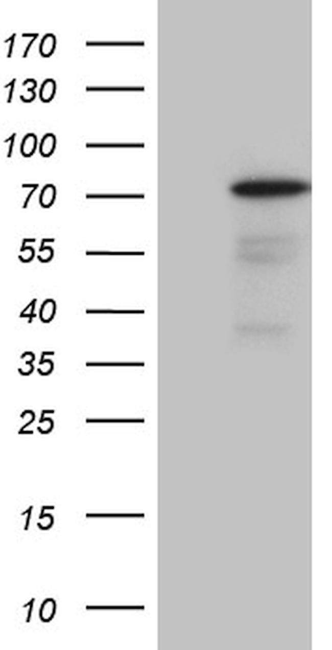 PGBD3 Antibody in Western Blot (WB)