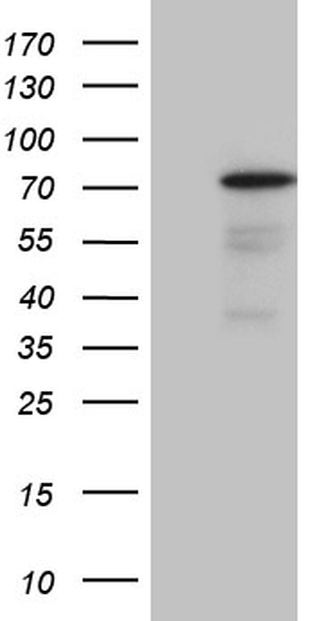 PGBD3 Antibody in Western Blot (WB)