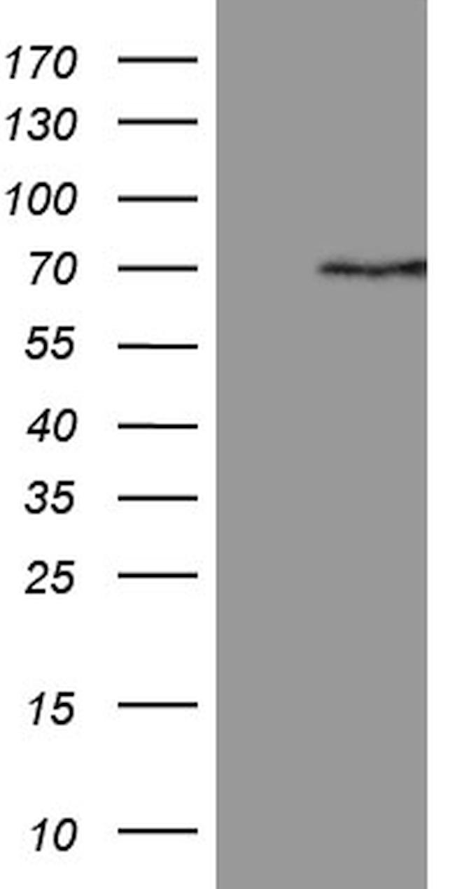 PGBD3 Antibody in Western Blot (WB)