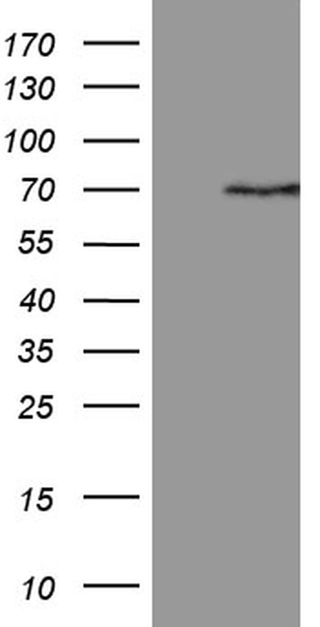 PGBD3 Antibody in Western Blot (WB)