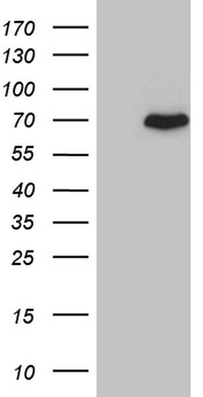 PGBD3 Antibody in Western Blot (WB)