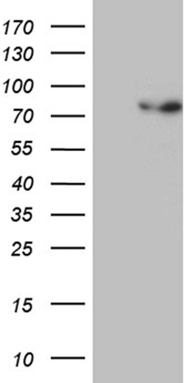 PGBD3 Antibody in Western Blot (WB)