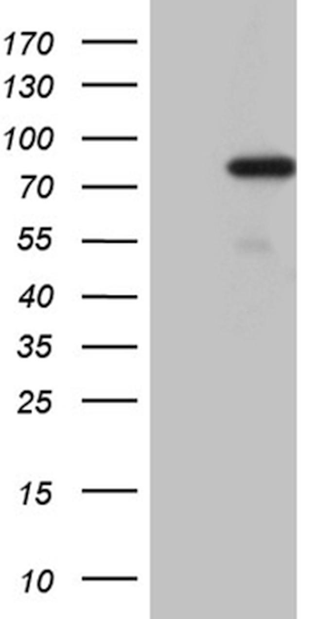 PGBD3 Antibody in Western Blot (WB)