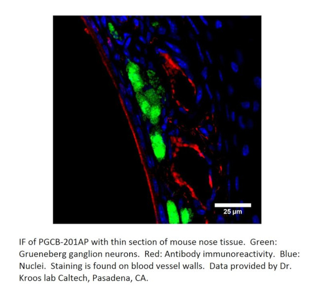 PGCB Antibody in Immunohistochemistry (IHC)