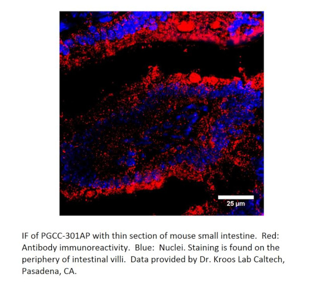 Particulate Guanylate Cyclase C Antibody in Immunohistochemistry (IHC)