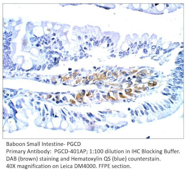 PGCD Antibody in Immunohistochemistry (IHC)