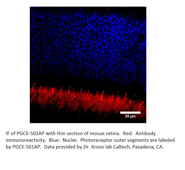 PGCE Antibody in Immunohistochemistry (IHC)