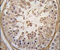 PGK2 Antibody in Immunohistochemistry (IHC)