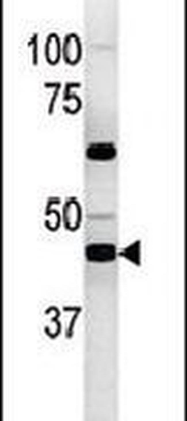 PGK2 Antibody in Western Blot (WB)