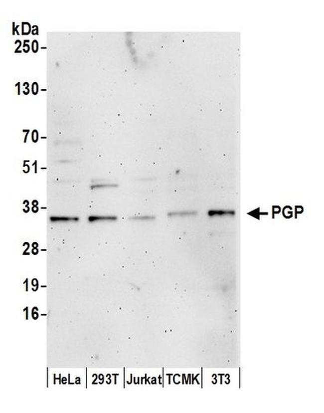 PGP Antibody in Western Blot (WB)