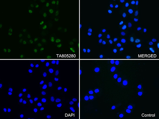 PGR Antibody in Immunocytochemistry (ICC/IF)