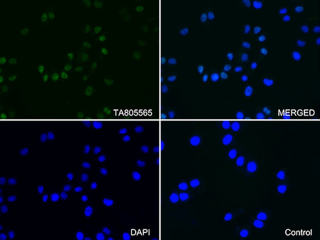 PGR Antibody in Immunocytochemistry (ICC/IF)
