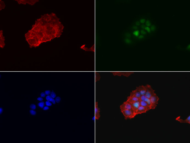 PGR Antibody in Immunocytochemistry (ICC/IF)