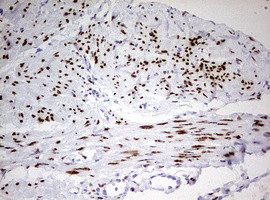 PGR Antibody in Immunohistochemistry (Paraffin) (IHC (P))