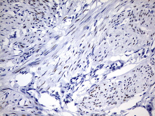 PGR Antibody in Immunohistochemistry (Paraffin) (IHC (P))