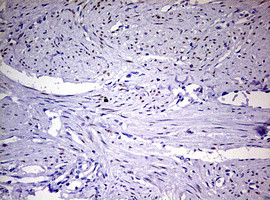 PGR Antibody in Immunohistochemistry (Paraffin) (IHC (P))