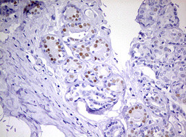 PGR Antibody in Immunohistochemistry (Paraffin) (IHC (P))
