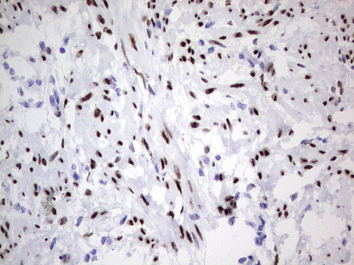 PGR Antibody in Immunohistochemistry (Paraffin) (IHC (P))