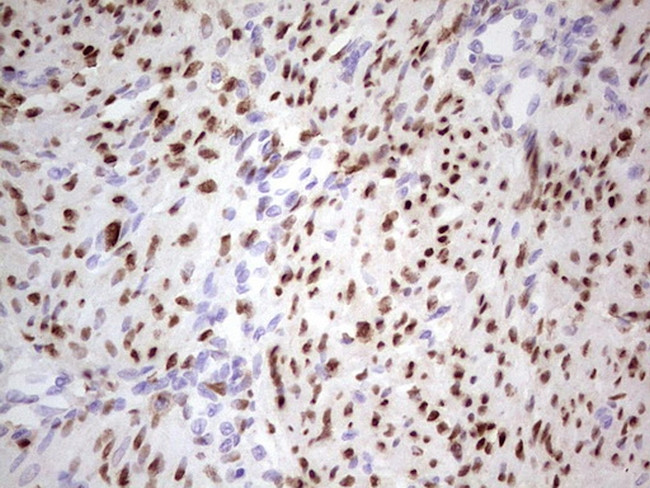 PGR Antibody in Immunohistochemistry (Paraffin) (IHC (P))