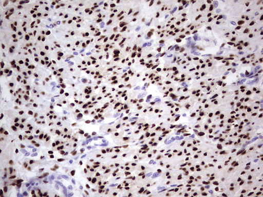 PGR Antibody in Immunohistochemistry (Paraffin) (IHC (P))