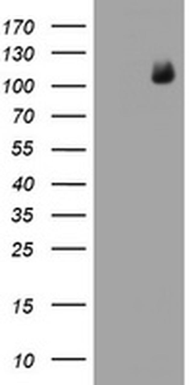 PGR Antibody in Western Blot (WB)