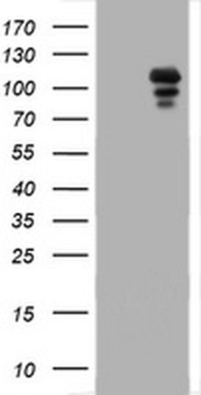 PGR Antibody in Western Blot (WB)