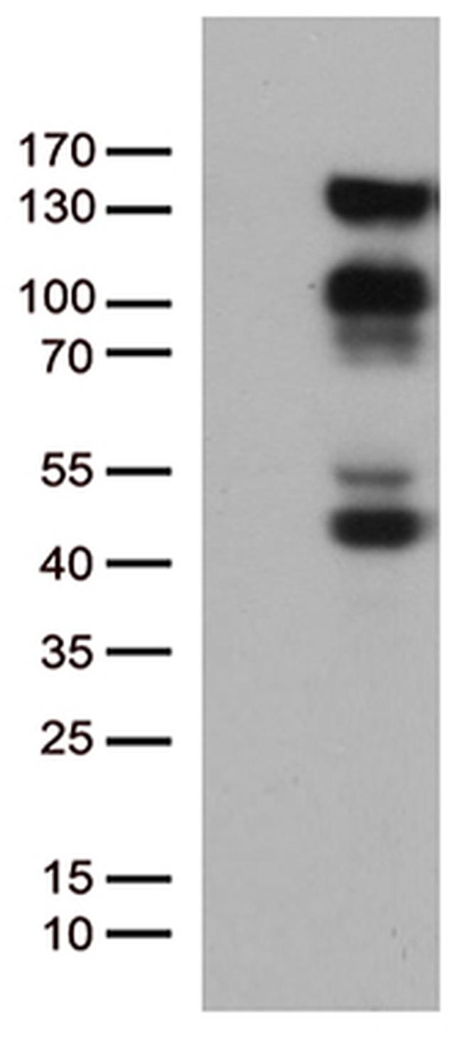 PGR Antibody in Western Blot (WB)