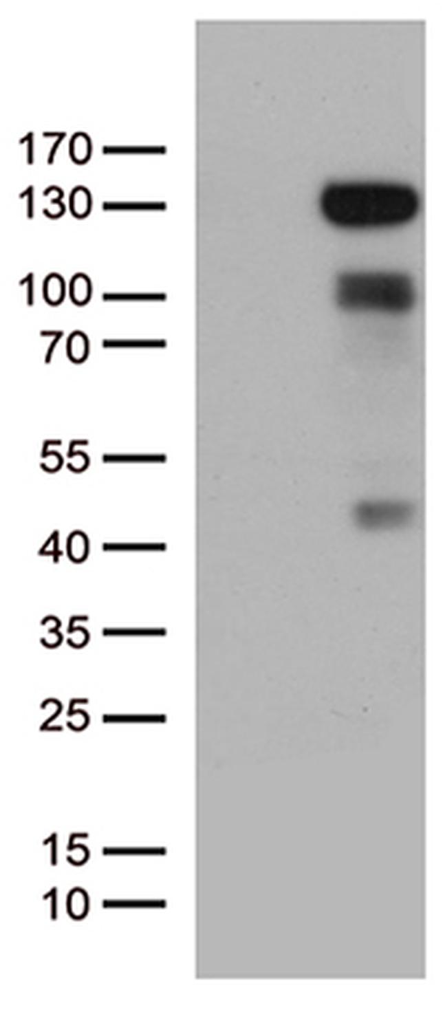 PGR Antibody in Western Blot (WB)