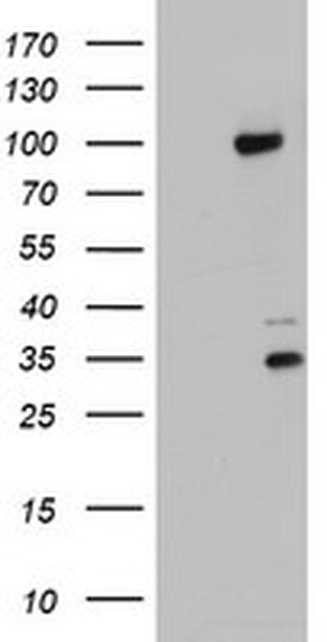 PGR Antibody in Western Blot (WB)