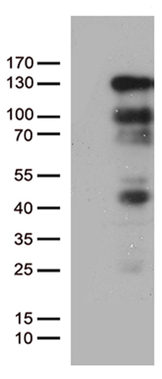 PGR Antibody in Western Blot (WB)