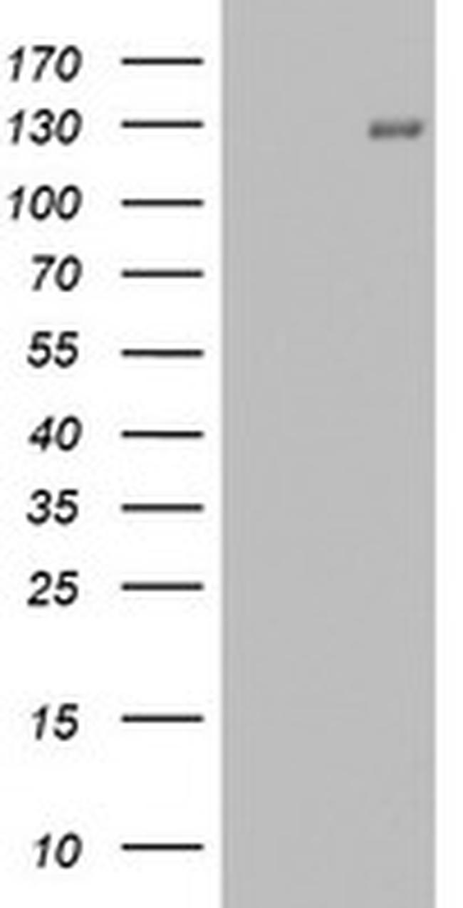 PGR Antibody in Western Blot (WB)