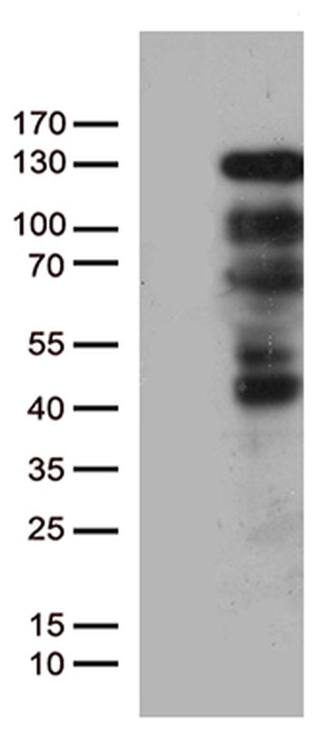 PGR Antibody in Western Blot (WB)