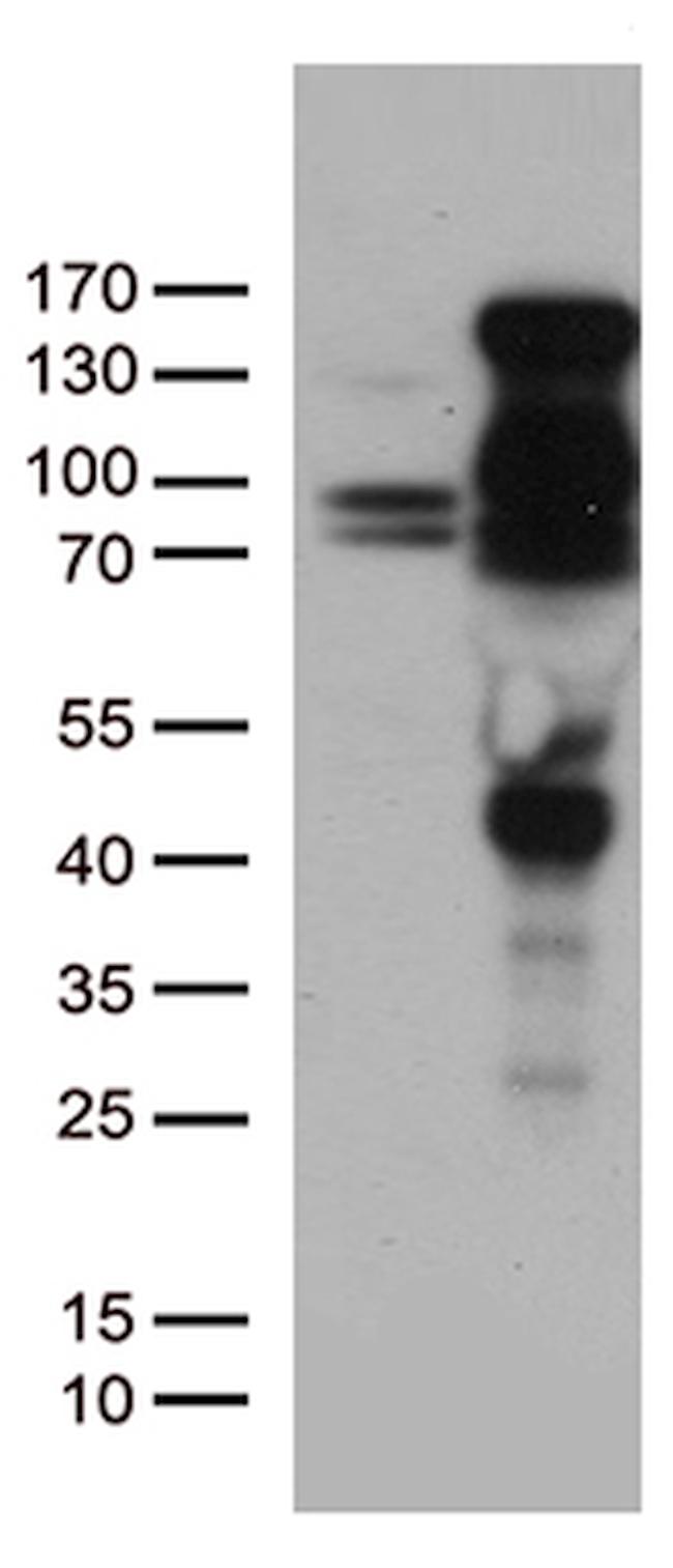 PGR Antibody in Western Blot (WB)