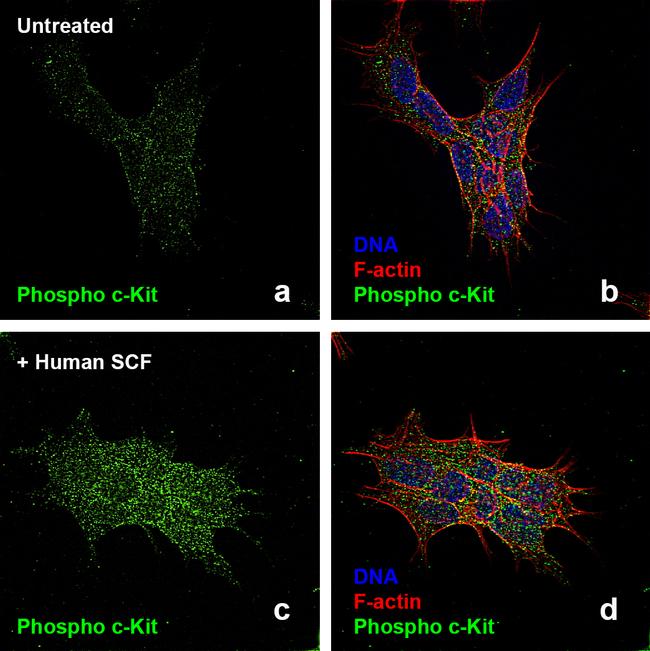 Human SCF Protein in Bioactivity (Bioactivity)