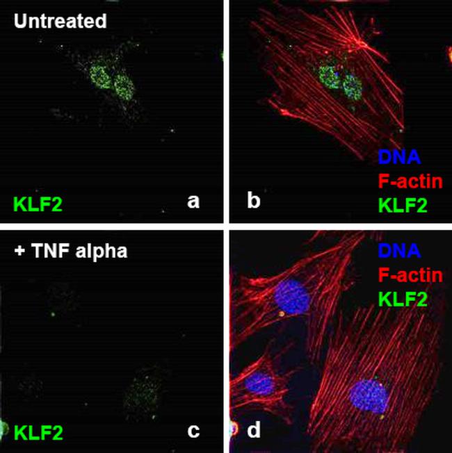 Human TNF-alpha Protein in Bioactivity (Bioactivity)