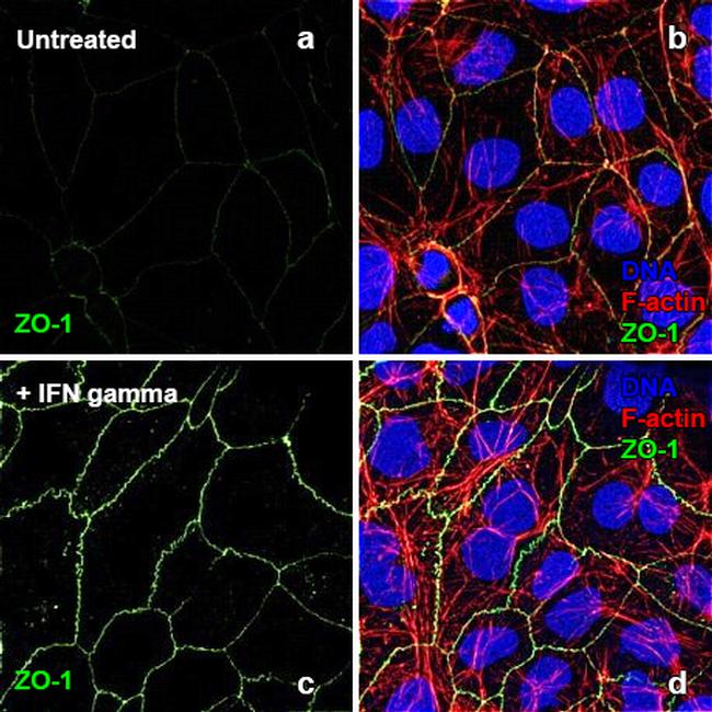 Human IFN-gamma Protein in Bioactivity (Bioactivity)