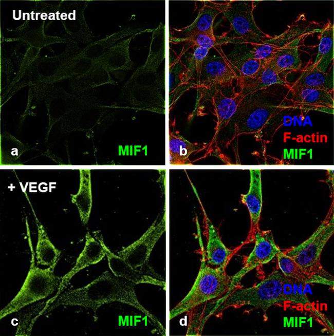Human VEGF-165 Protein in Bioactivity (Bioactivity)