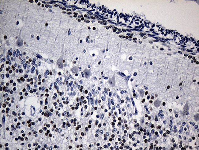 PHF20L1 Antibody in Immunohistochemistry (Paraffin) (IHC (P))