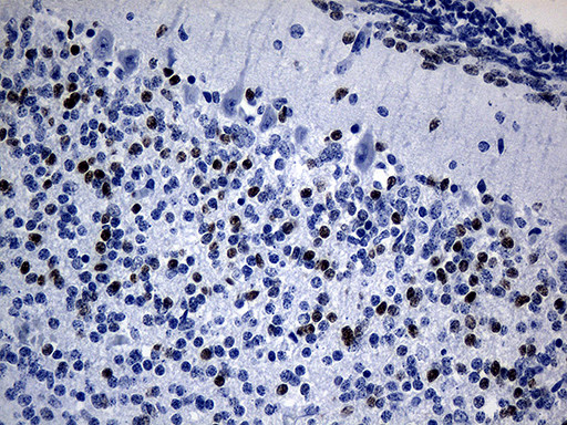 PHF20L1 Antibody in Immunohistochemistry (Paraffin) (IHC (P))