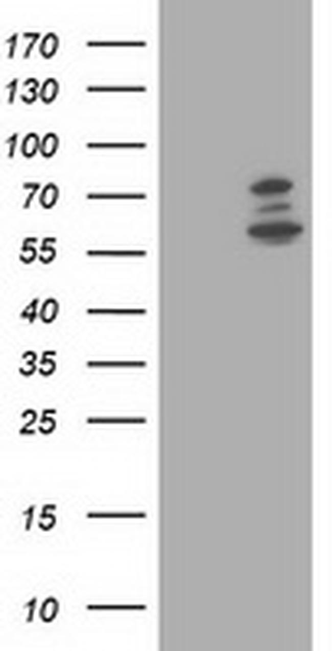 PHF21B Antibody in Western Blot (WB)