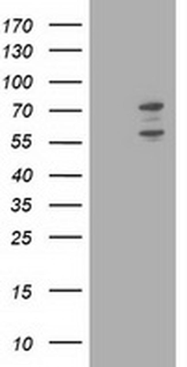 PHF21B Antibody in Western Blot (WB)