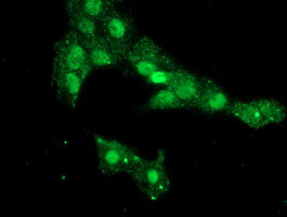 PHF7 Antibody in Immunocytochemistry (ICC/IF)