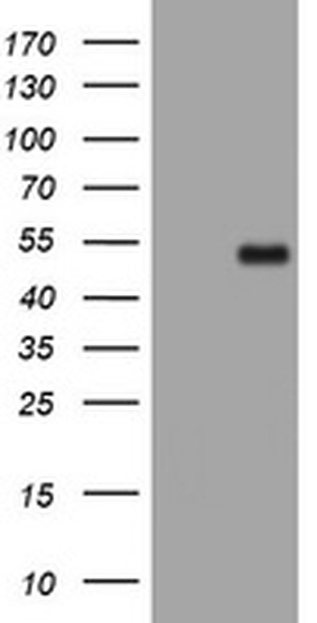 PHF7 Antibody in Western Blot (WB)