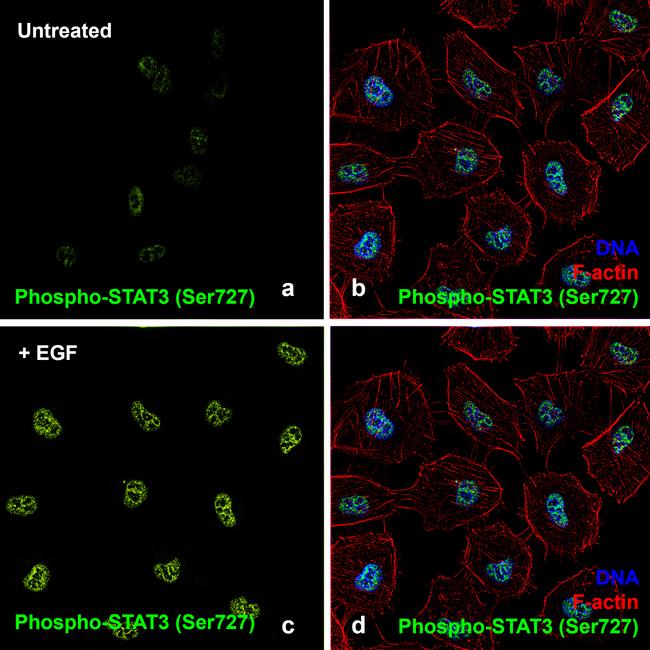 Human EGF Protein in Bioactivity (Bioactivity)