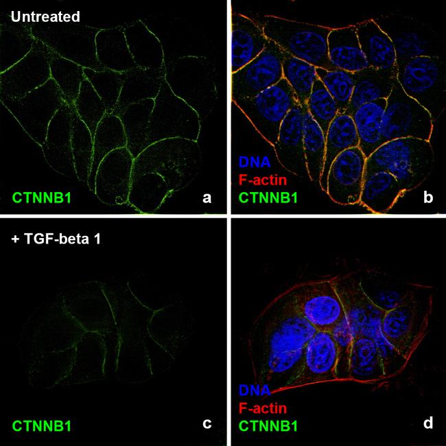 Human TGF-beta 1 Protein in Bioactivity (Bioactivity)