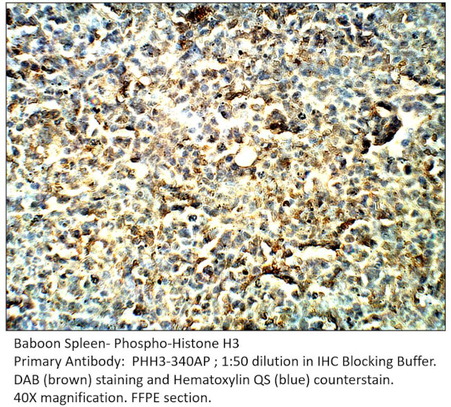 Phospho-Histone H3 (Ser10) Antibody in Immunohistochemistry (IHC)